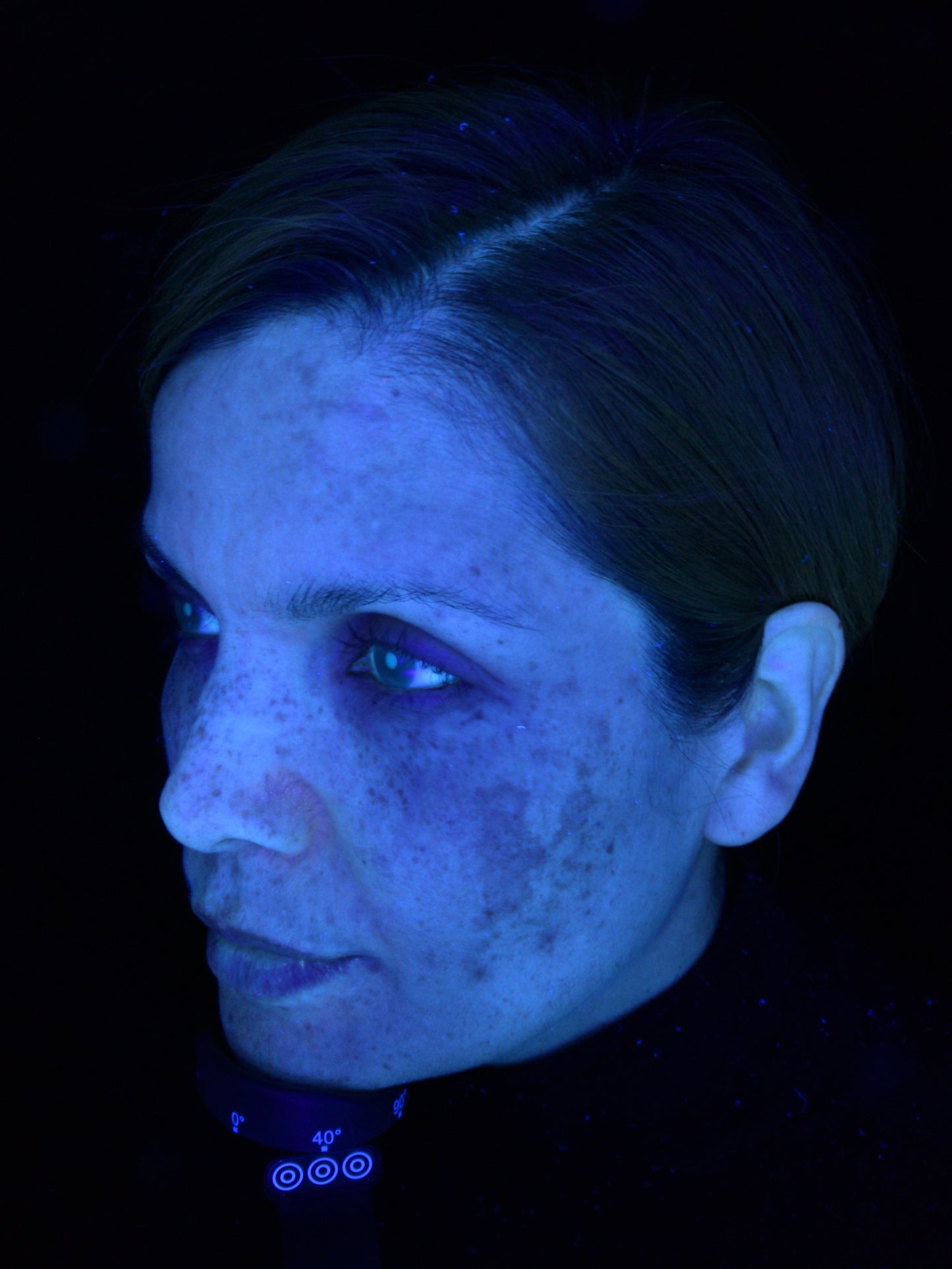 OBSERVE 520 Skin Analyst Face Imaging - your 1st appointment