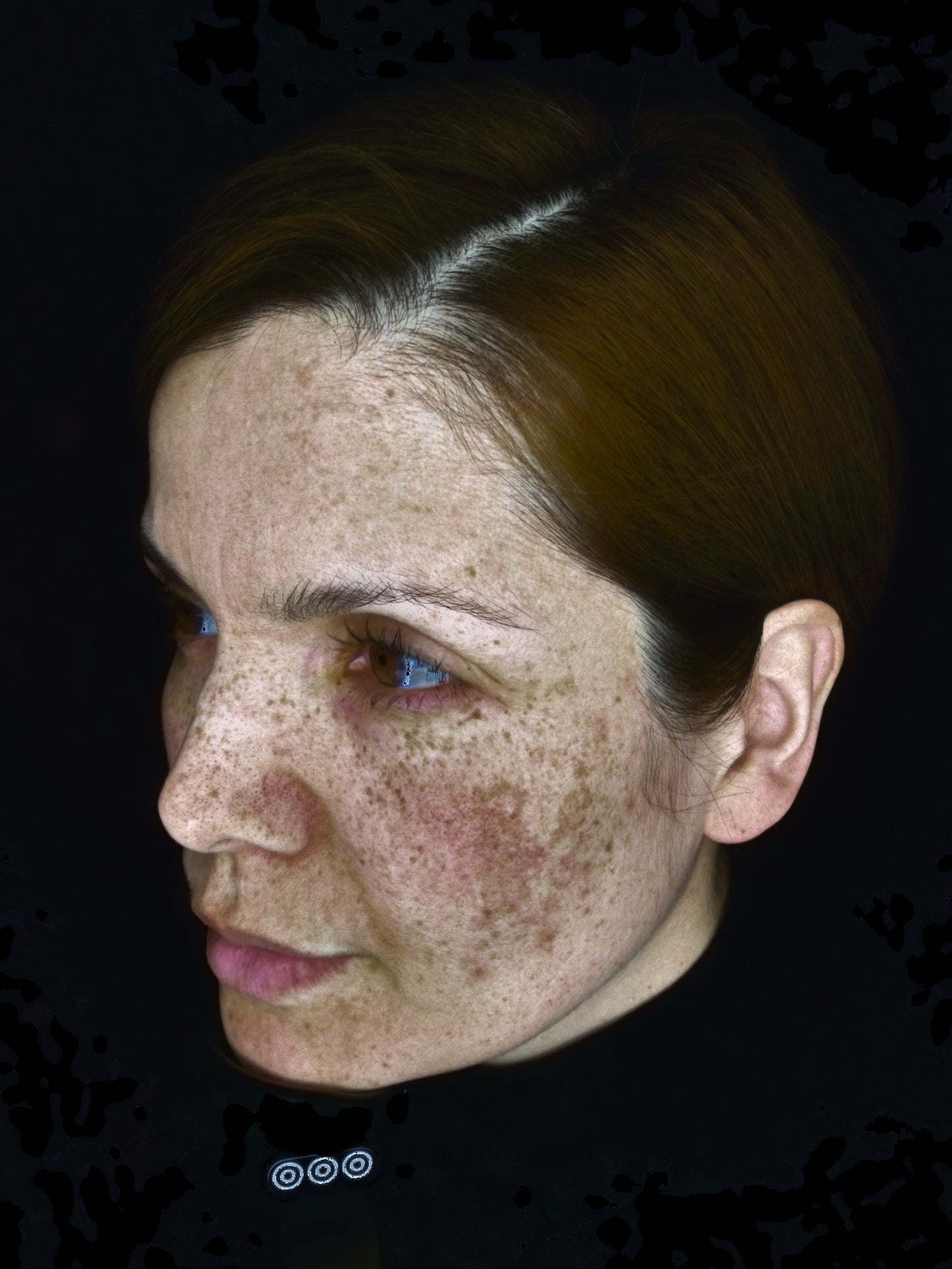 OBSERVE 520 Skin Analyst Face Imaging - your 1st appointment