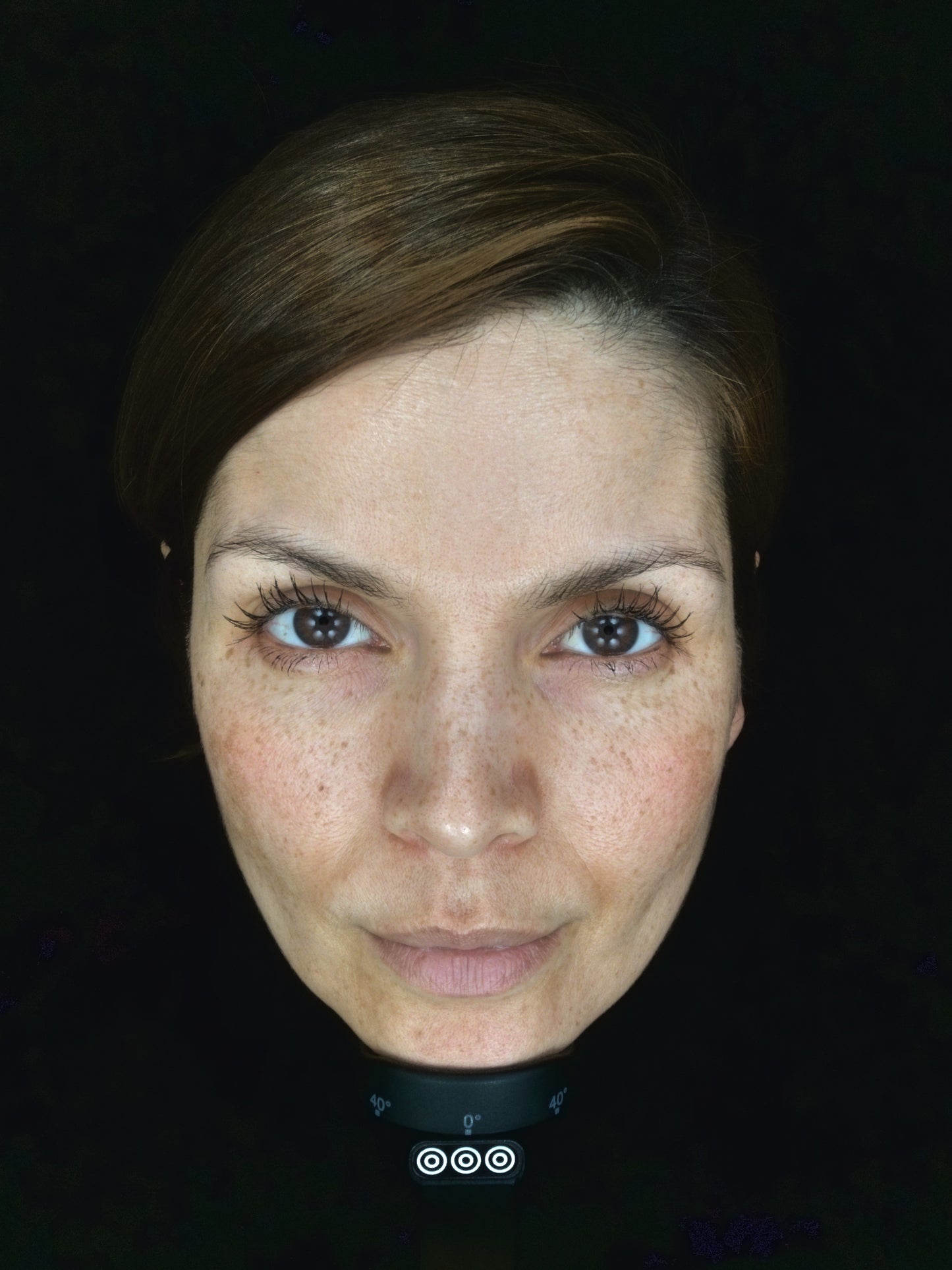 OBSERVE 520 Skin Analyst Face Imaging - your 1st appointment