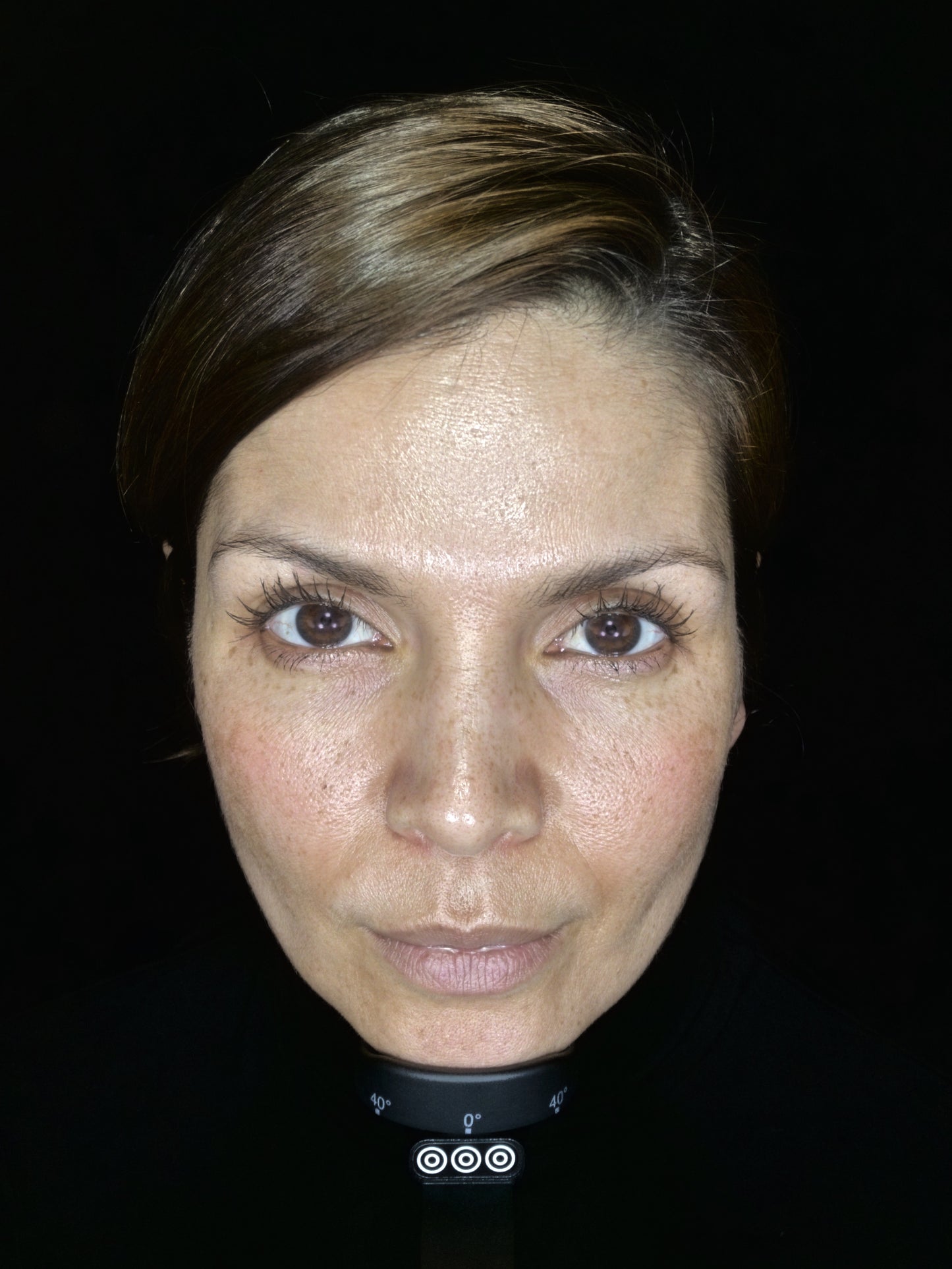 OBSERVE 520 Skin Analyst Face Imaging - your 1st appointment