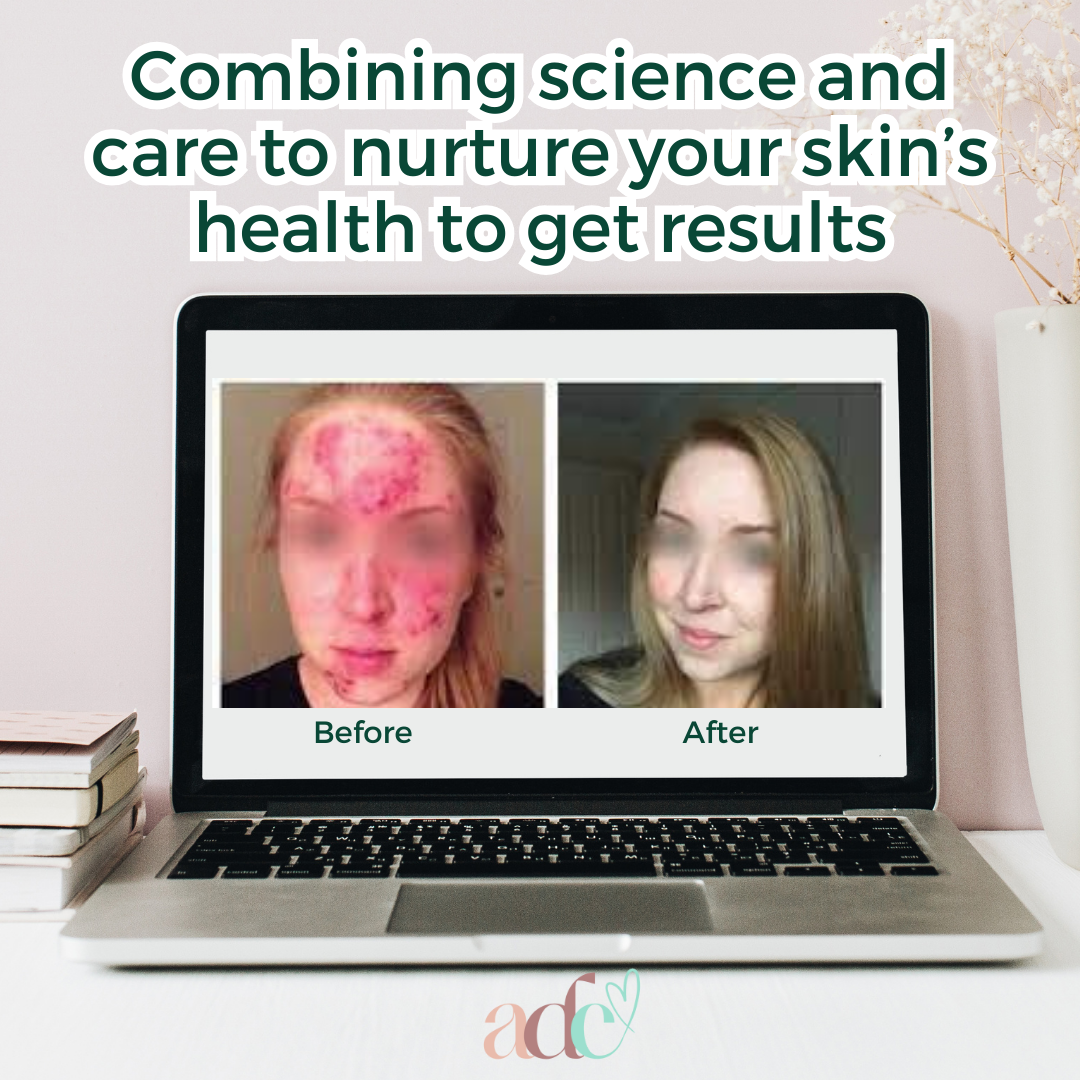 Telehealth Dermal Skin Video Appointments Australia Wide