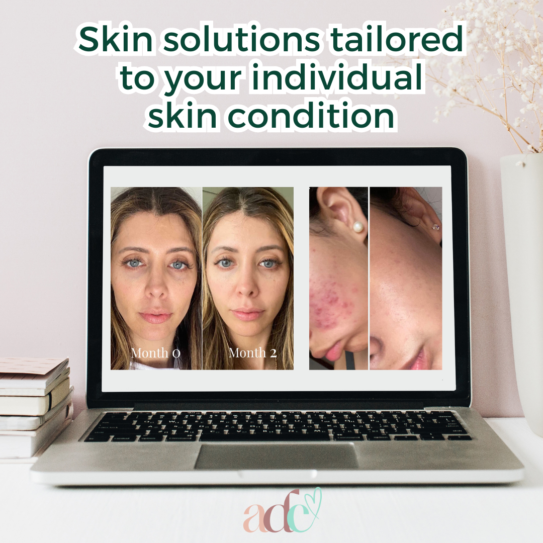 Telehealth Dermal Skin Video Appointments Australia Wide