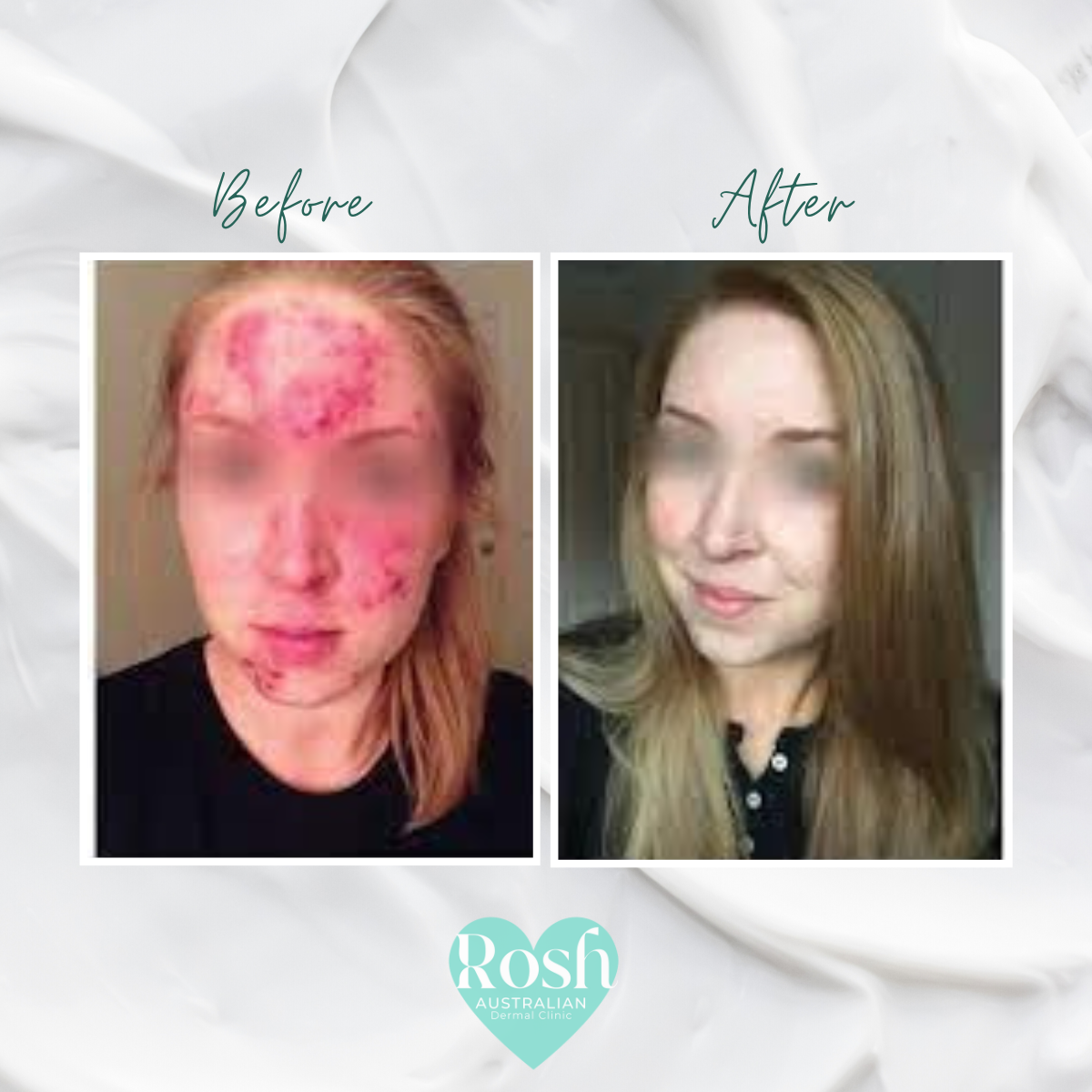 Telehealth Dermal Skin Video Appointments Australia Wide