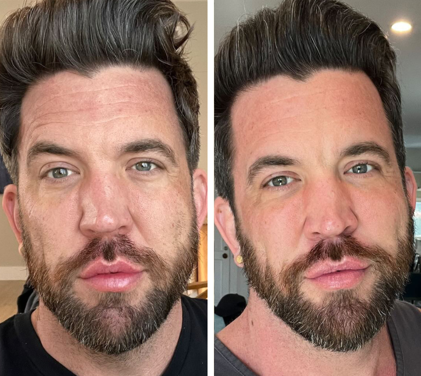 Omnilux Men Face Mask - Medical Grade LED Light Therapy