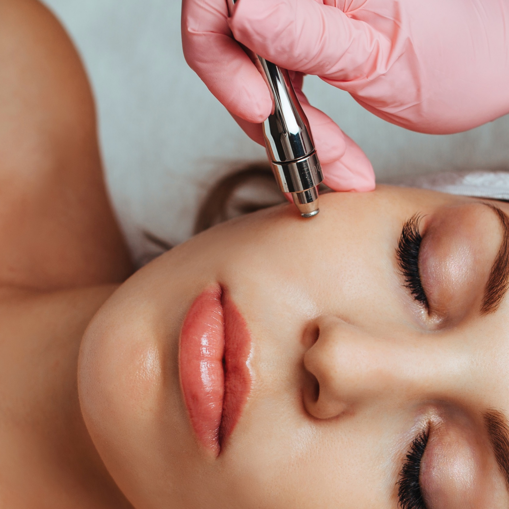 Welcome to Clairderm crystal/diamond microdermabrasion, a non-invasive and gentle process that can rejuvenate and heal your skin. Our qualified staff uses crystals accelerated at high velocity to abrade and exfoliate dead and damaged skin cells, leaving you with smoother, brighter, firmer, and blemish-free skin. Skin beauty salon located Narellan Camden Macarthur SW Sydney NSW