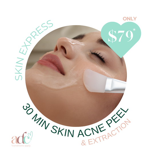 Skin Express: 30-Minute Acne Peel and Extraction Boost