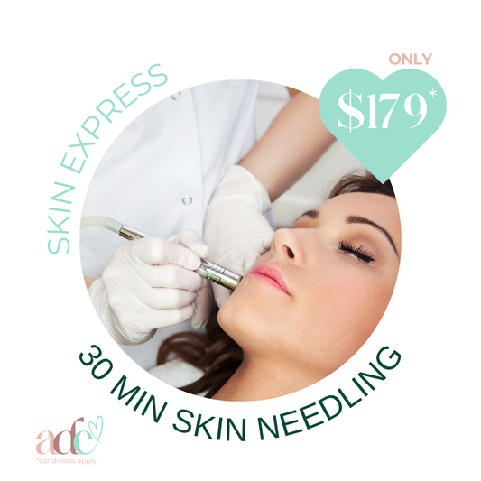 Skin Express: 30-Minute Skin Needling Boost