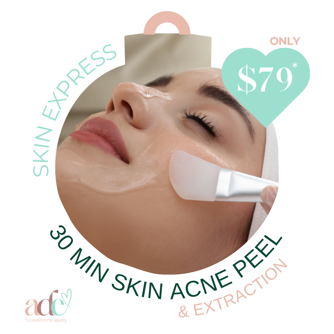 Skin Express: 30-Minute Acne Peel and Extraction Boost