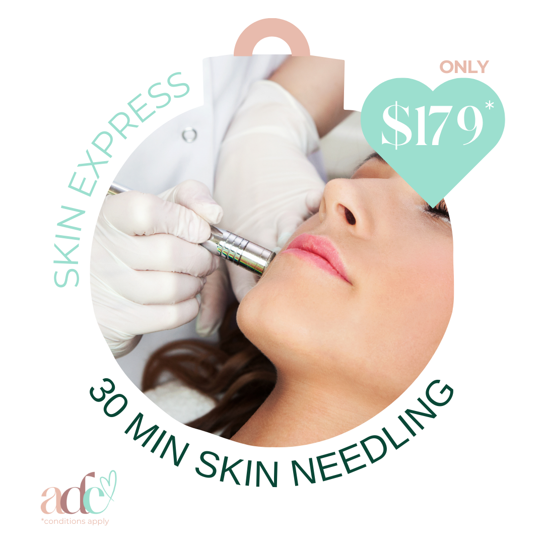 Skin Express: 30-Minute Skin Needling Boost