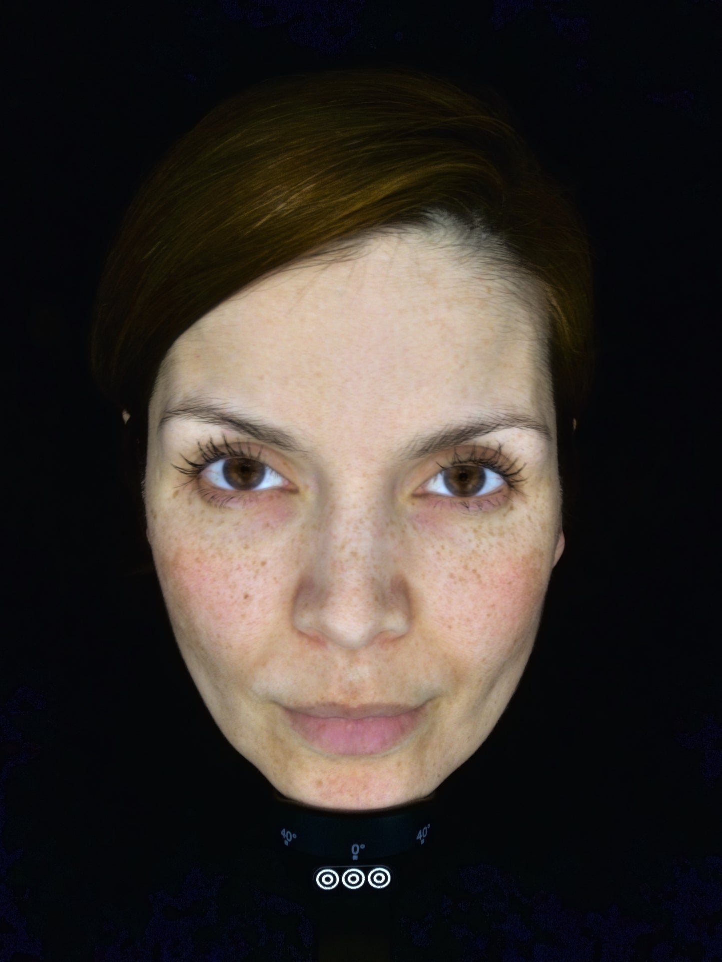 OBSERVE 520 Skin Analyst Face Imaging - your 1st appointment