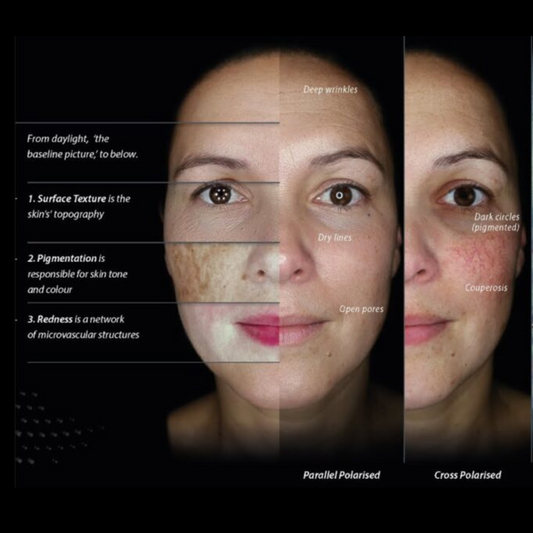 OBSERVE 520 Skin Analyst Face Imaging - your 1st appointment