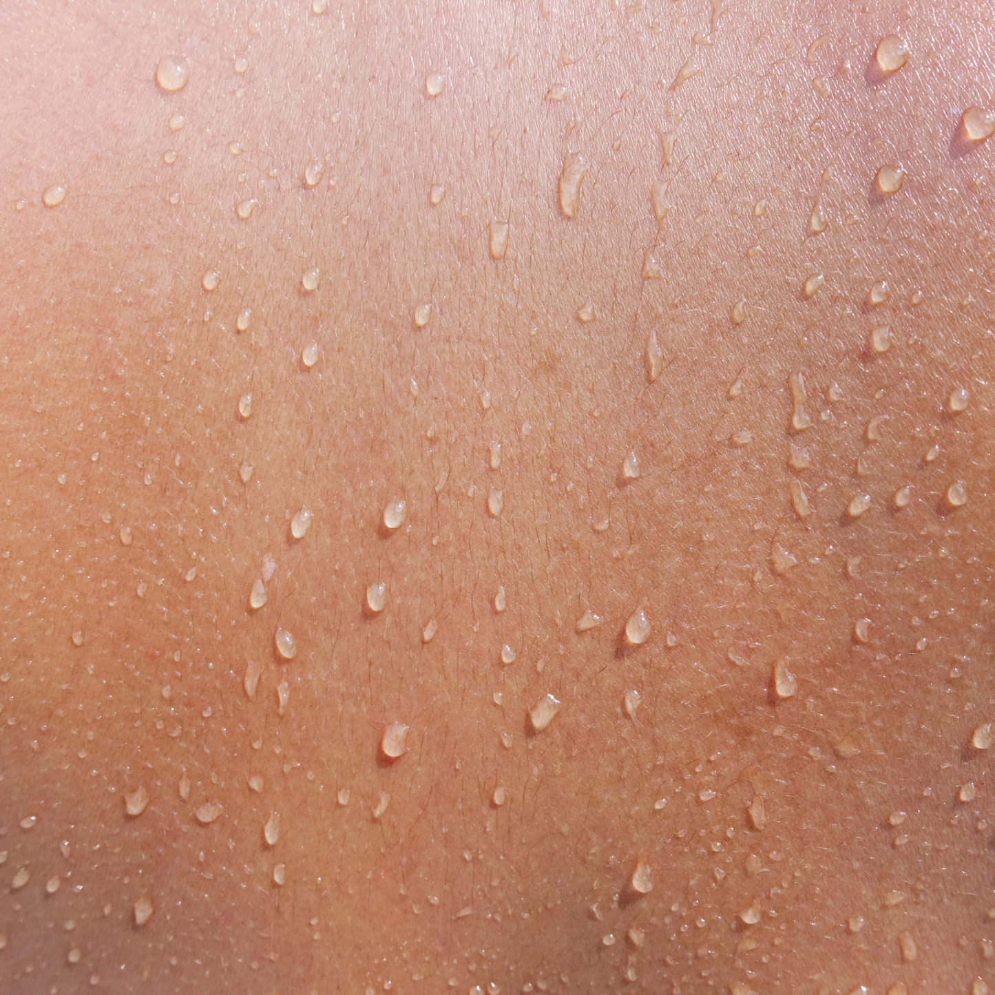 Oleogel N by Dermaviduals - inflammatory skin disorders like dermatitis